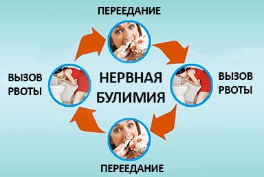 Лечение булимии в Новопавловске